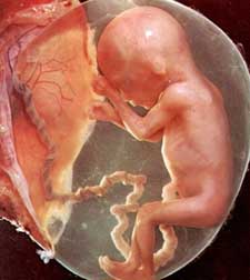 von embryo zum baby
